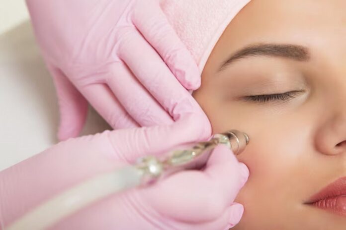 Skin Microneedling